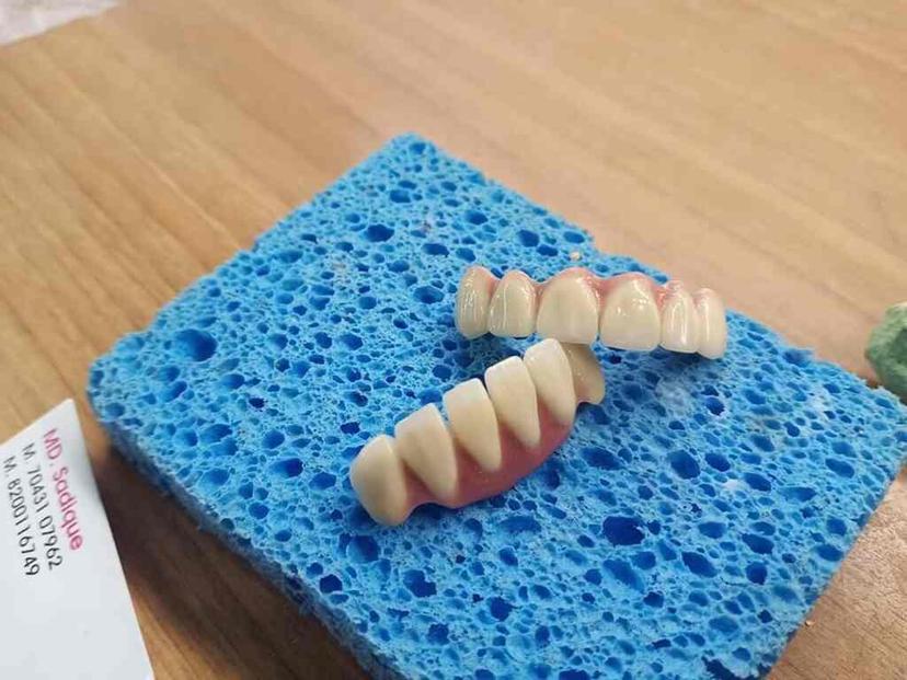 Custom Crown & Denture Work
